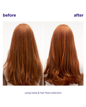 Head & Hair Heal Shampoo + Conditioner Duo