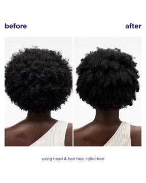Head & Hair Heal Shampoo + Conditioner Duo